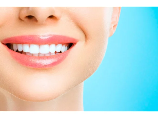 Jak zastavit zubní kámen. Tipy, které fungují