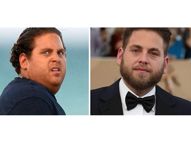 Extrémní proměny slavných, které braly dech. Tloušťka i přehnaná štíhlost