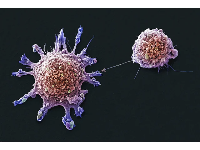 Čeští vědci ukázali „invazi“ nádorových buněk. V boji s rakovinou využili magnety