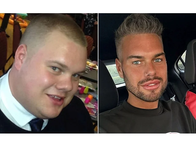 Z tlouštíka fešákem. Muž se po plastikách mění v Kena