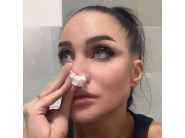 Jizvička bude, je smířená Andrea Pomeje, které pes ukousl kus nosu