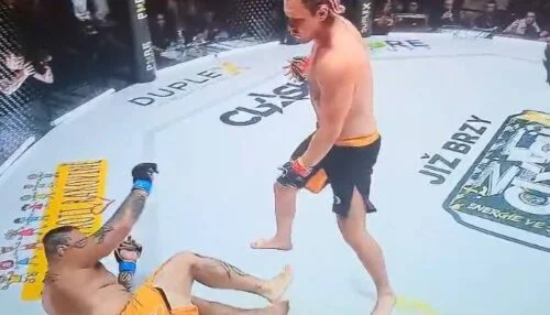 Kotlár padl po přesné bombě na bradu. Prozradil, že má kameny ve žlučníku