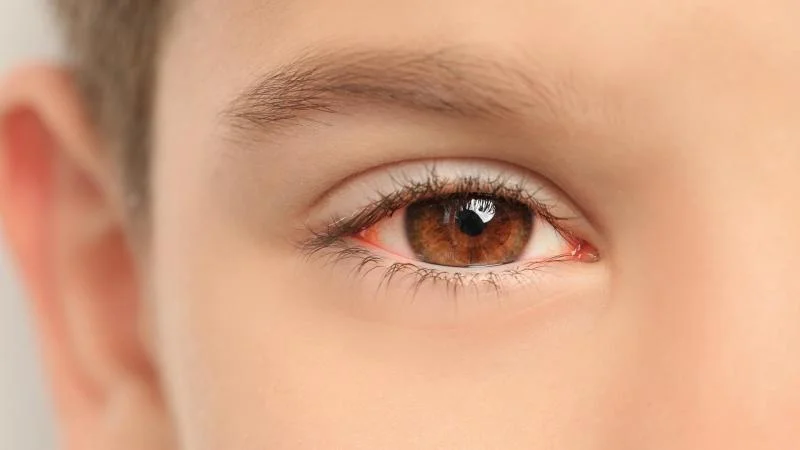 Cyril Děckař radí: Jak zvládnout zánět spojivek u dětí? Rodiče zapomínají řešit hlavně rýmu