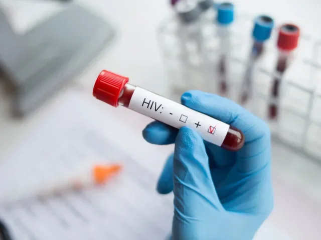 Loni za 11 měsíců přibylo 272 pacientů s HIV, víc než za rok 2024