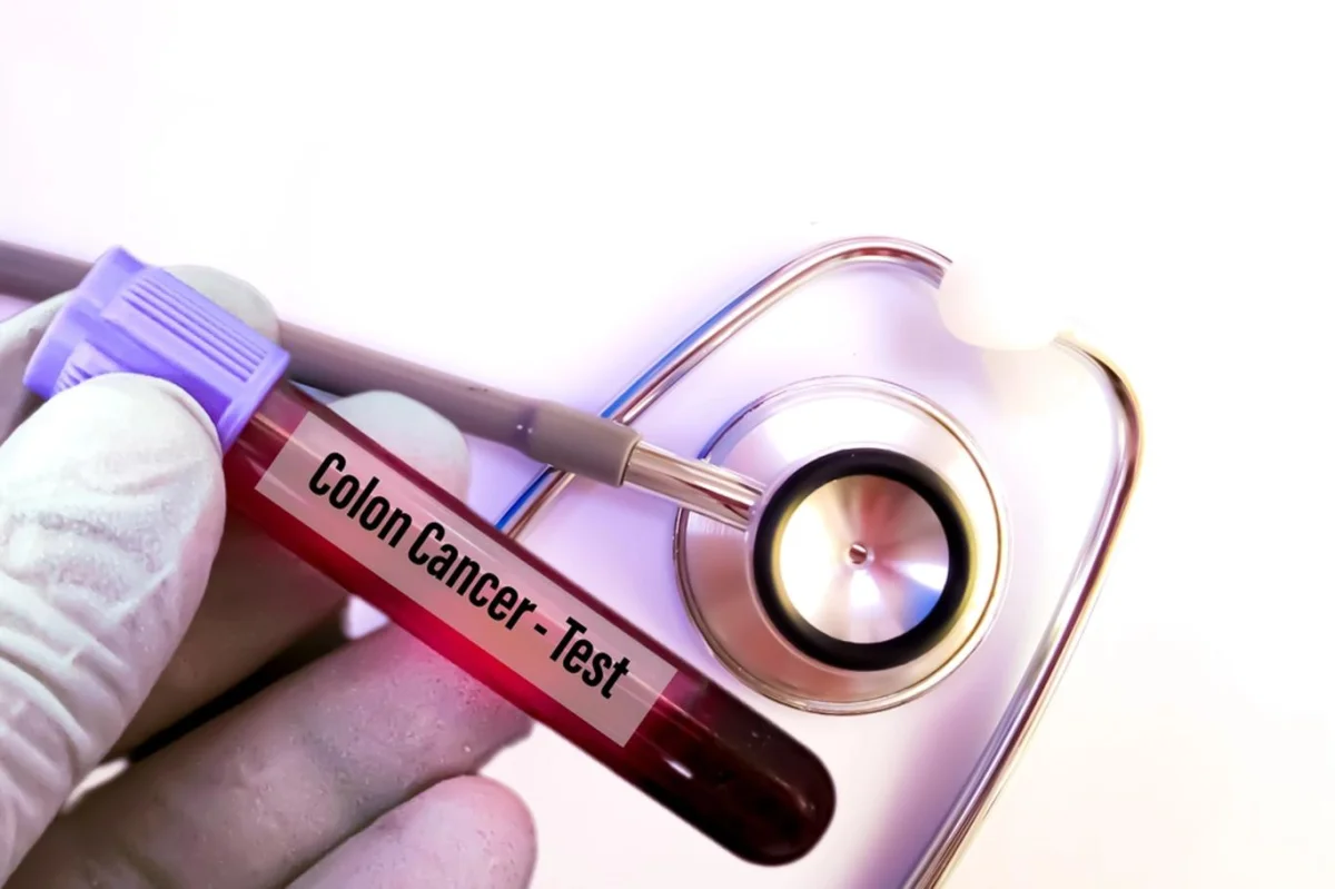 Myslíte, že jde o banalitu? Rakovina konečníku takhle často začíná - Zdraví kondice.cz článek na Media24.cz