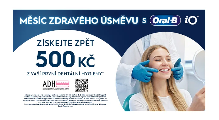 Třetina Čechů nikdy nebyla na dentální hygieně. Domácí péče přitom nestačí