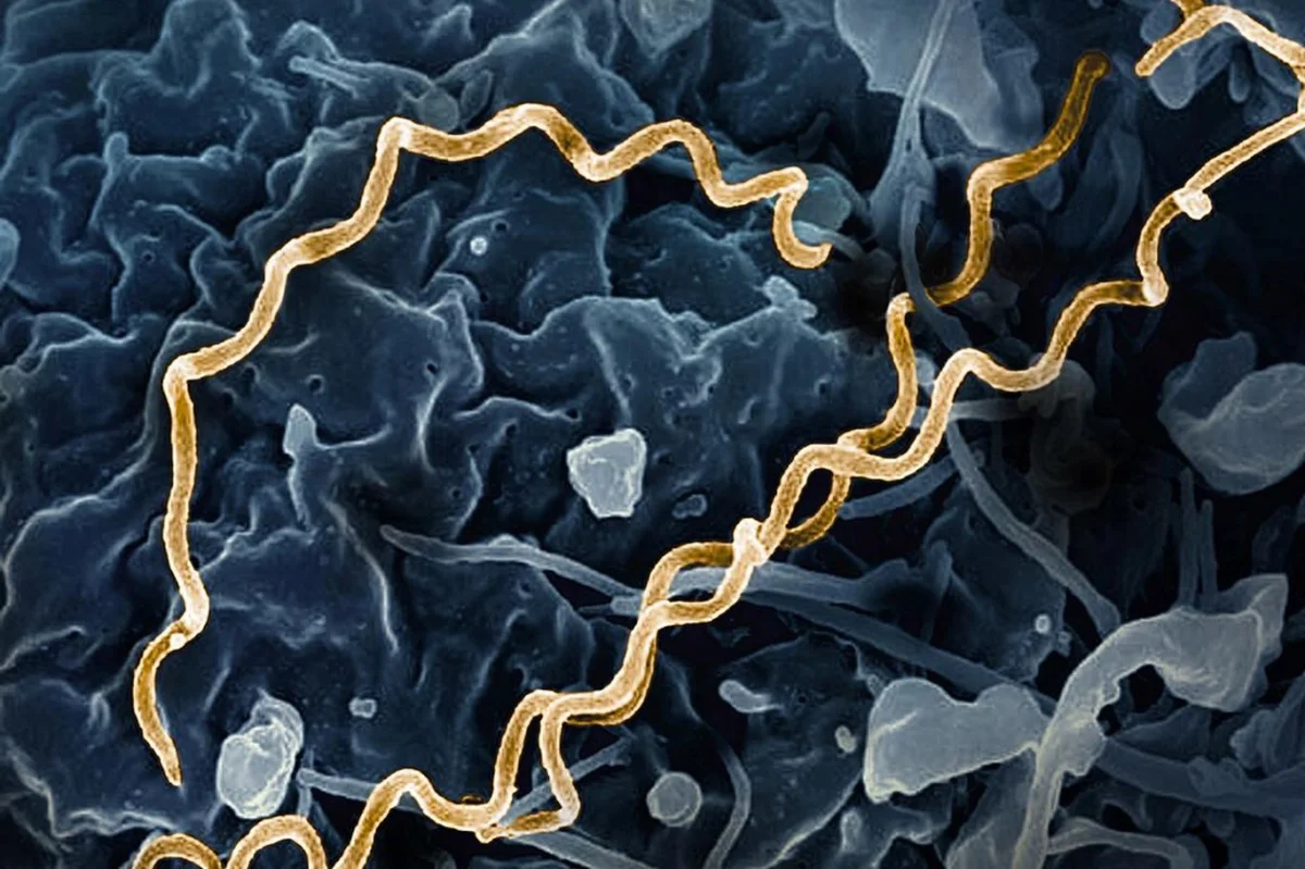 Odkud se rozšířil syfilis? Lidé se nakazili pohlavní nemocí mnohem dříve, než se myslelo, uvedl tým vědců