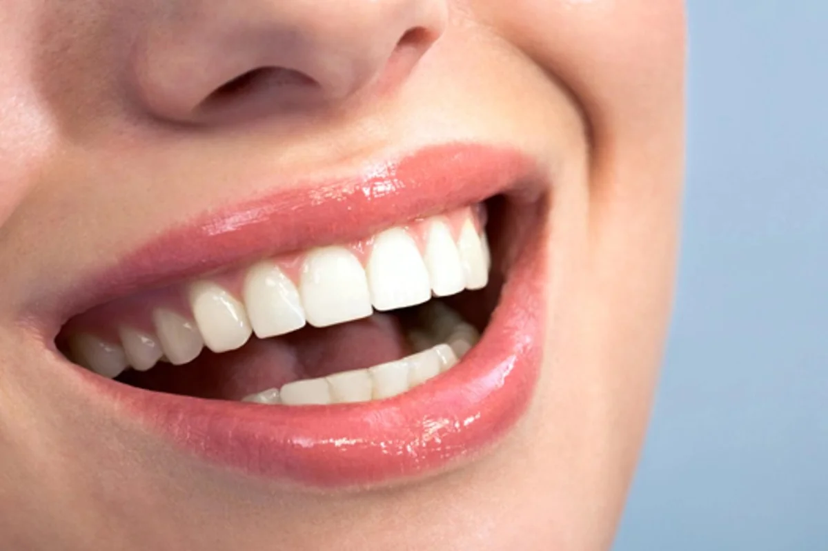 Instagram slibuje zázraky na bělení zubů. Zubař říká, co funguje a co škodí - Zdraví kondice.cz článek na Media24.cz