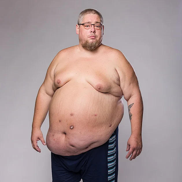 Extrémní proměny: 200 kilový táta na mateřské se bojí smrti. Krutý ortel lékařů! - Zdraví EXPRES.CZ článek na Media24.cz